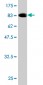 CHFR Antibody (monoclonal) (M01)