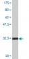 CHFR Antibody (monoclonal) (M08)
