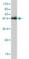 CHML Antibody (monoclonal) (M03)