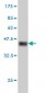 CHRM2 Antibody (monoclonal) (M01)