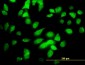 CHUK Antibody (monoclonal) (M03)