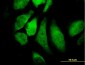 CHUK Antibody (monoclonal) (M04)