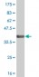 CHUK Antibody (monoclonal) (M04)