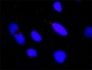 CHUK Antibody (monoclonal) (M04)