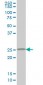 CIDEB Antibody (monoclonal) (M01)