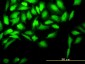 CKS2 Antibody (monoclonal) (M01)