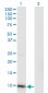 CKS2 Antibody (monoclonal) (M01)