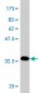 CKS2 Antibody (monoclonal) (M02)