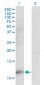 CKS2 Antibody (monoclonal) (M02)