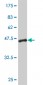 CLEC2D Antibody (monoclonal) (M01)
