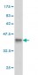 CLIC3 Antibody (monoclonal) (M02)