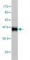 CLPP Antibody (monoclonal) (M01)
