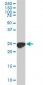 CLPP Antibody (monoclonal) (M01)