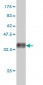 CNAP1 Antibody (monoclonal) (M01)