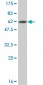 CNOT7 Antibody (monoclonal) (M01)