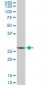 CNOT7 Antibody (monoclonal) (M01)