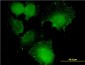 CNOT7 Antibody (monoclonal) (M01)