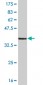 CNR1 Antibody (monoclonal) (M01)