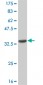 CNR2 Antibody (monoclonal) (M01)