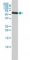 COASY Antibody (monoclonal) (M01)