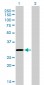 COASY Antibody (monoclonal) (M01)