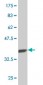 COASY Antibody (monoclonal) (M05)