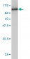 COL5A1 Antibody (monoclonal) (M01)