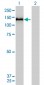 COL6A2 Antibody (monoclonal) (M01)