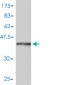 COMT Antibody (monoclonal) (M01)