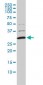 COMT Antibody (monoclonal) (M01)