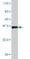 CORO1A Antibody (monoclonal) (M01)