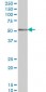 CORO1A Antibody (monoclonal) (M01)