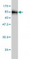 CORO1B Antibody (monoclonal) (M01)