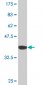 CORO1C Antibody (monoclonal) (M02)