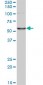 CORO1C Antibody (monoclonal) (M02)