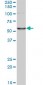 CORO1C Antibody (monoclonal) (M02)