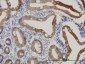 CPS1 Antibody (monoclonal) (M01)