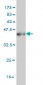 CPS1 Antibody (monoclonal) (M01)