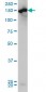 CPS1 Antibody (monoclonal) (M01)