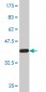 CPS1 Antibody (monoclonal) (M02)