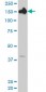 CPS1 Antibody (monoclonal) (M02)