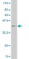 CPT2 Antibody (monoclonal) (M02)