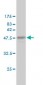 CRADD Antibody (monoclonal) (M01)