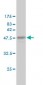 CRADD Antibody (monoclonal) (M01)