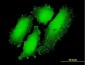 CREB3L4 Antibody (monoclonal) (M01)