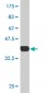 CREB5 Antibody (monoclonal) (M01)