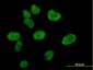 CREBBP Antibody (monoclonal) (M01)