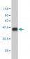 CREBBP Antibody (monoclonal) (M01)