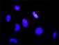 CREBBP Antibody (monoclonal) (M01)