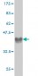CRIM1 Antibody (monoclonal) (M01)